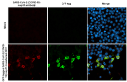 Anti-SARS-CoV-2 (COVID-19) nsp11 antibody [HL2388] used in Immunocytochemistry/ Immunofluorescence (ICC/IF). GTX638597